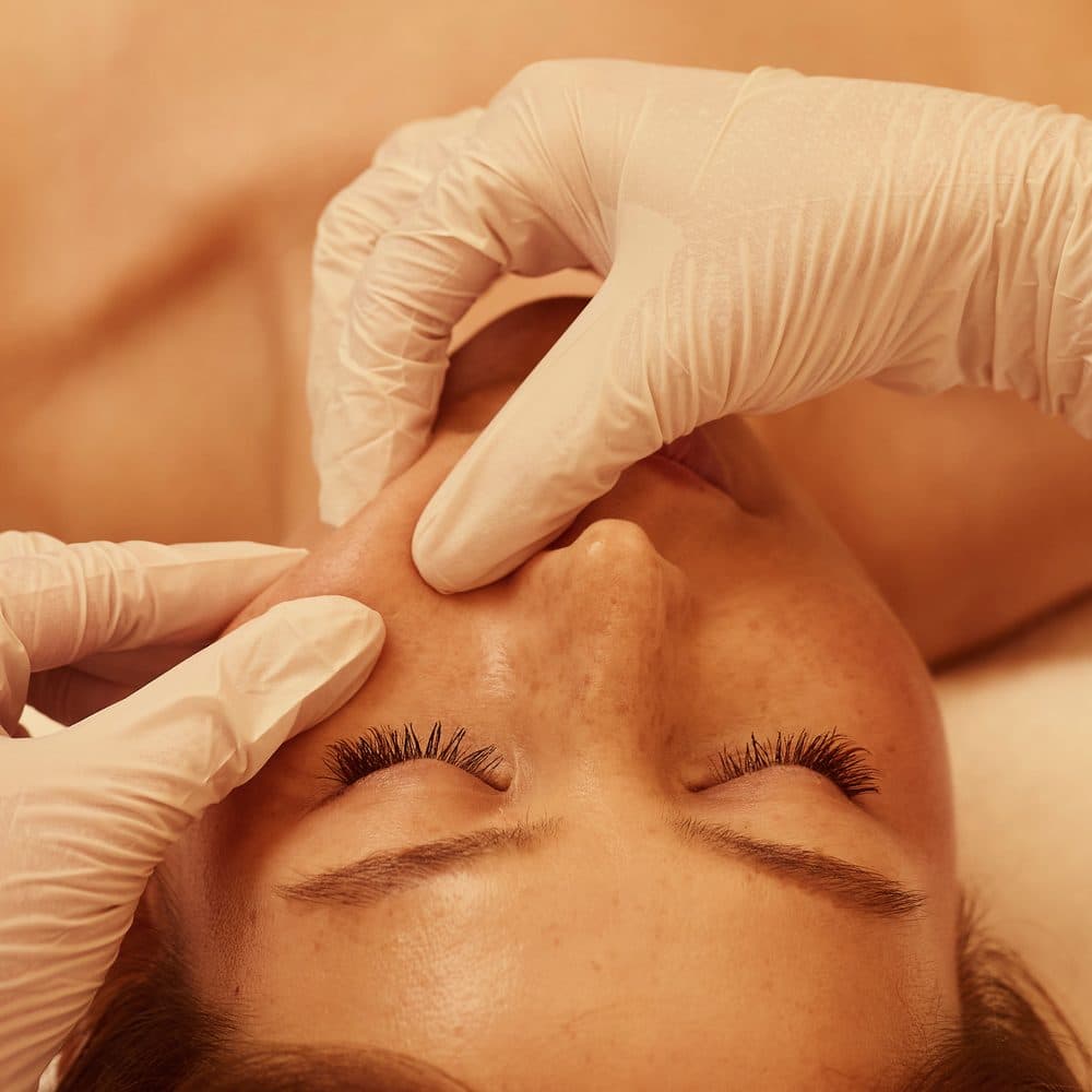 Zhanna Graeff working the nasolabial region